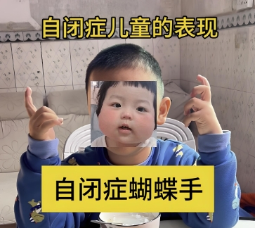 儿童自闭症蝴蝶手